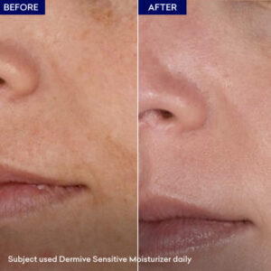 Dermive Sensitive Moisturizer - Image 4