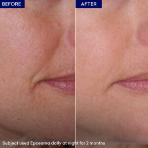 Epceama Anti Aging Scrum - Image 4