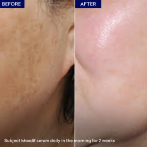 Maxdif Brightening Serum - Image 4