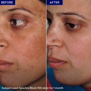 Spectra Block Sunblock Max SPF 100 - Image 4