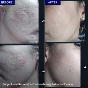 The Mandelac Face Wash - Image 4